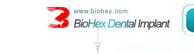 Dental Implant